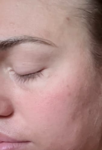 Customer photo review of Face & Eye Moisturiser 'Eyes Up Here'