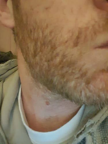 Customer photo review of Seb Natural Calming Serum