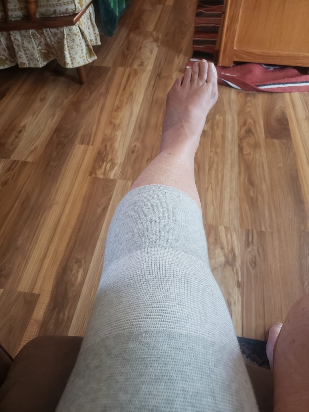 Customer photo review of VitalCompress – Premium Bambus-Kniebandage