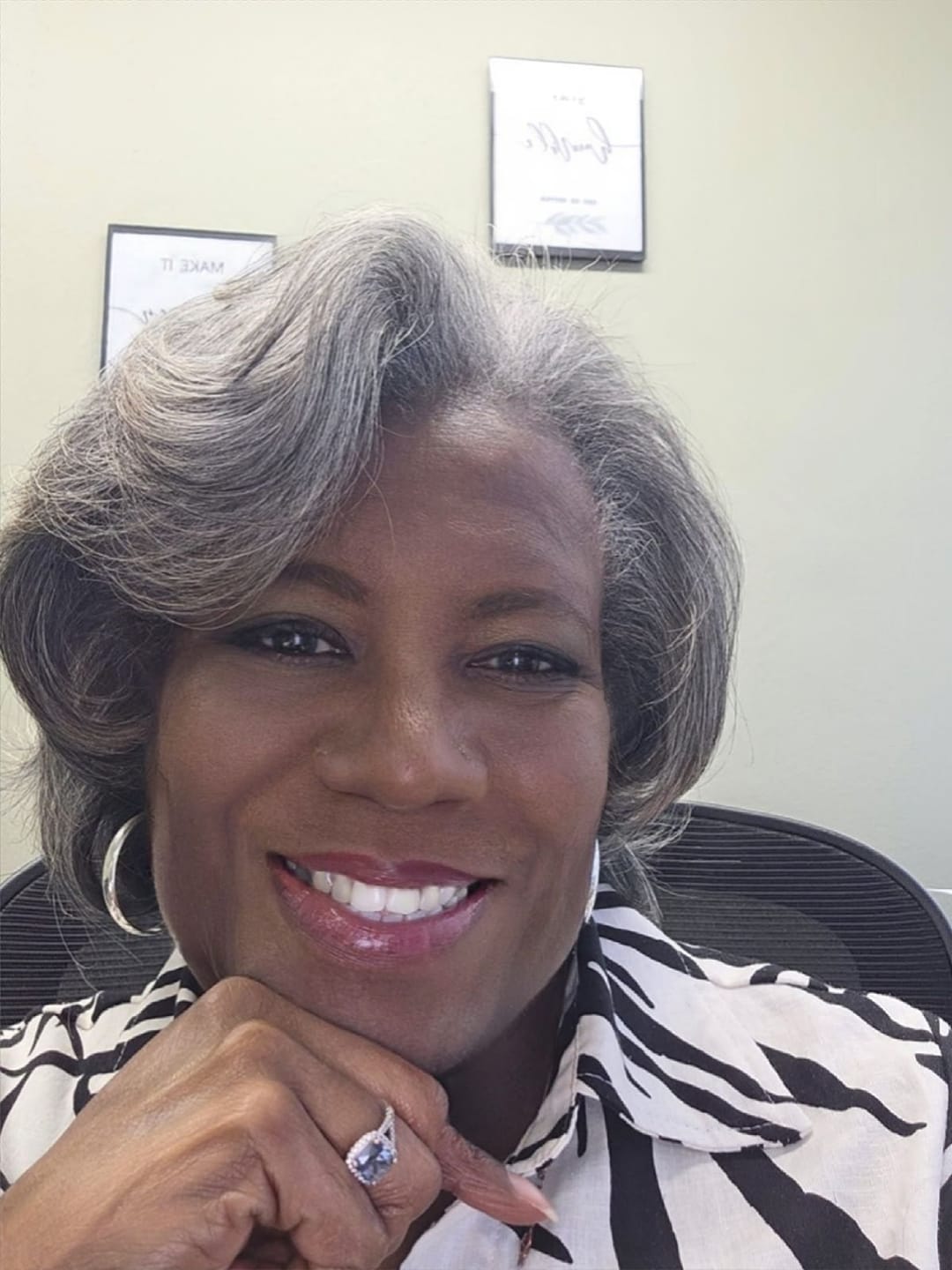 Customer photo review of Luvwin Salt And Pepper 5x5 Closure Pixie Cut Side Part Glueless Wig