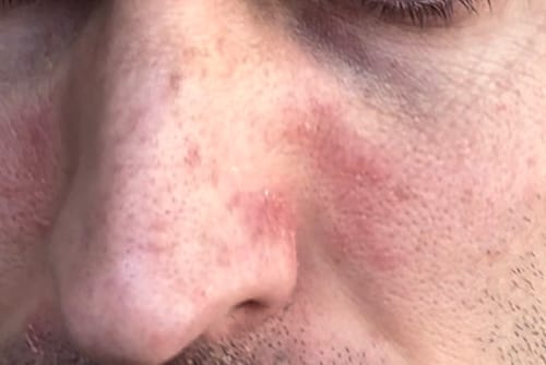 Customer photo review of Seb Natural Calming Serum