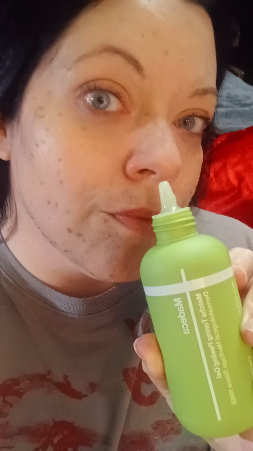 Customer photo review of Madeca Matcha Toning Peeling Gel 150ml