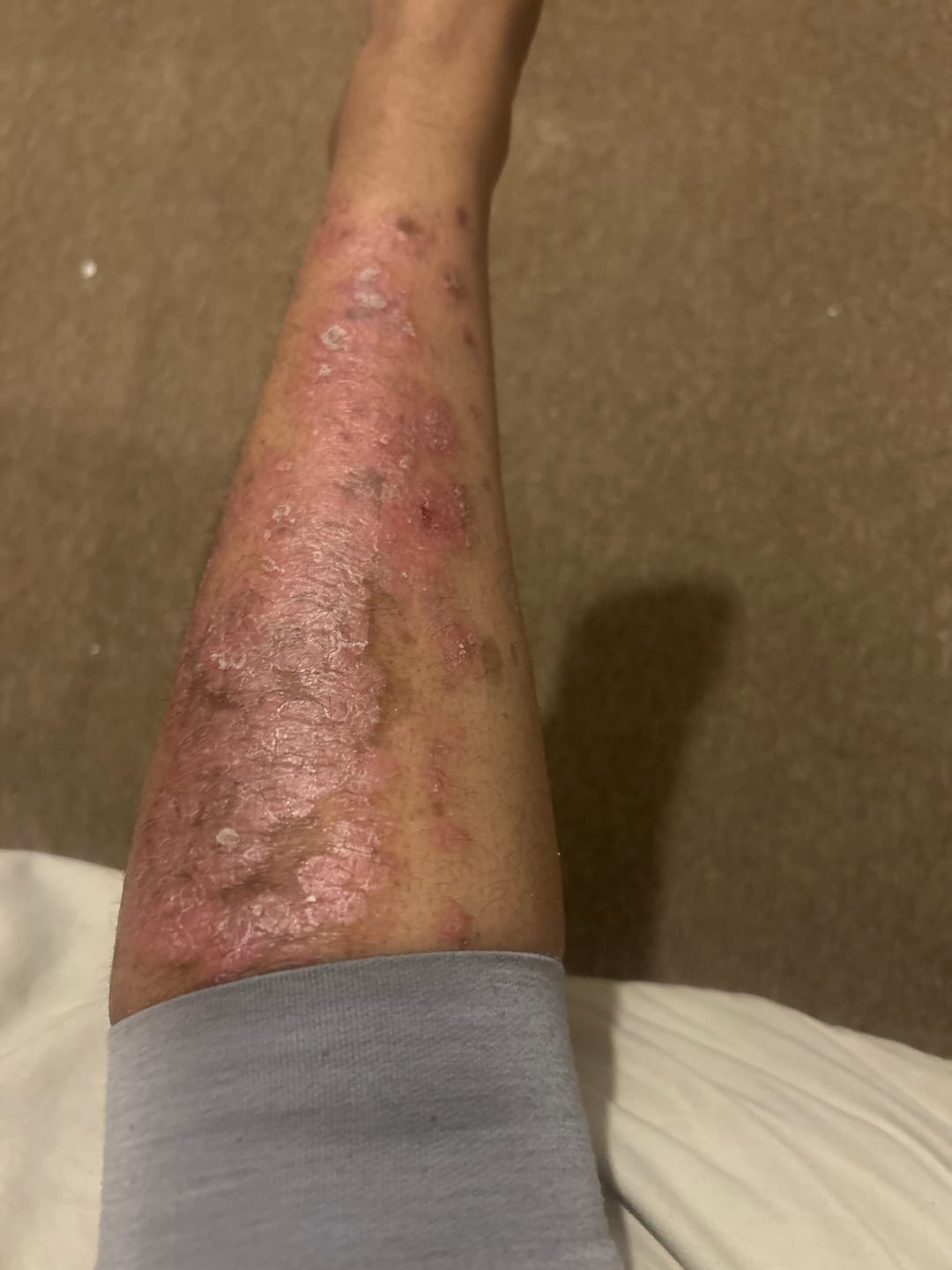 Customer photo review of Intensive Night Balm