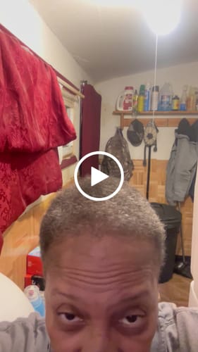 Customer video review of Rennora EXTRA-Strength Hair Growth Serum