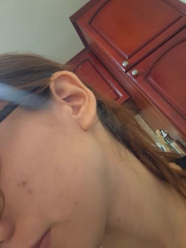 Customer photo review of Exosome Cica Toner