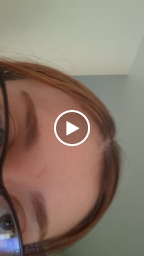 Customer video review of PDRN Booster Gel