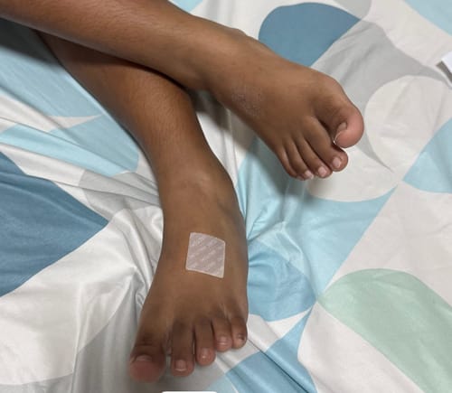 Customer photo review of HAUTUKI Growth Support Patch - 1 Month Supply (1Box)