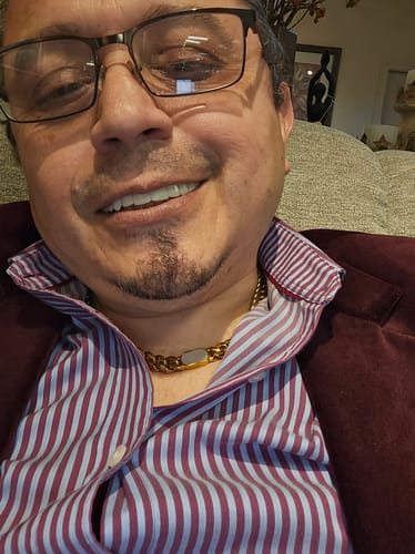 Customer photo review of Imako® Pink Fitting Material – Fake Gums