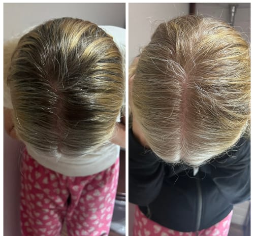 Customer photo review of Sunkissed Starter Kit