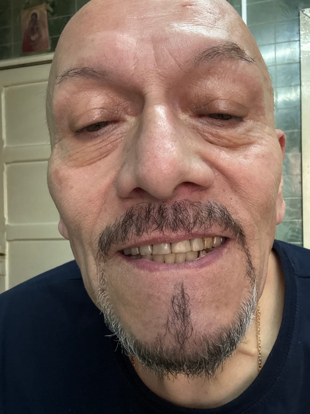Customer photo review of Kit Smile+