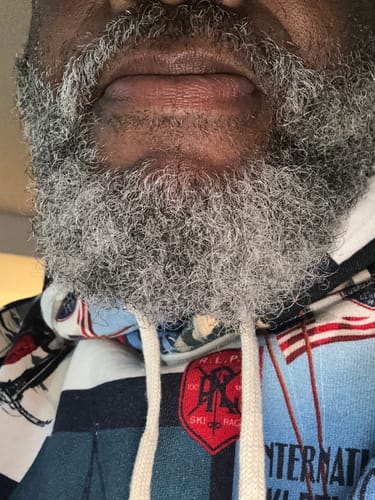 Customer photo review of Beard Care Kit