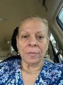 Customer photo review of Sistema de Microinfusão™ + Soro Bónus