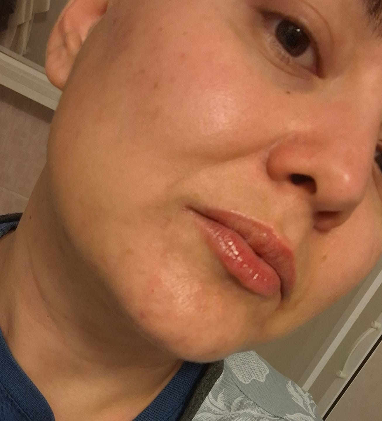 Customer photo review of Onarıcı Peptit Serum