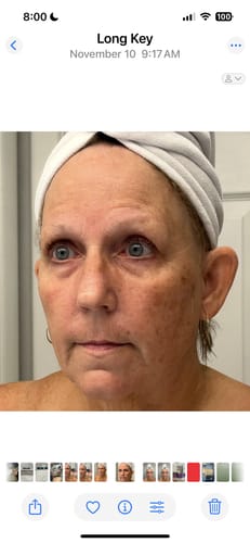 Customer photo review of Grass Fed Tallow & Honey Balm