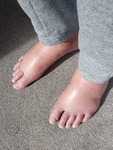 Customer photo review of Performance Eucalyptus Compression Socks