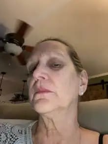 Customer photo review of Sistema de Microinfusão™ + Soro Bónus