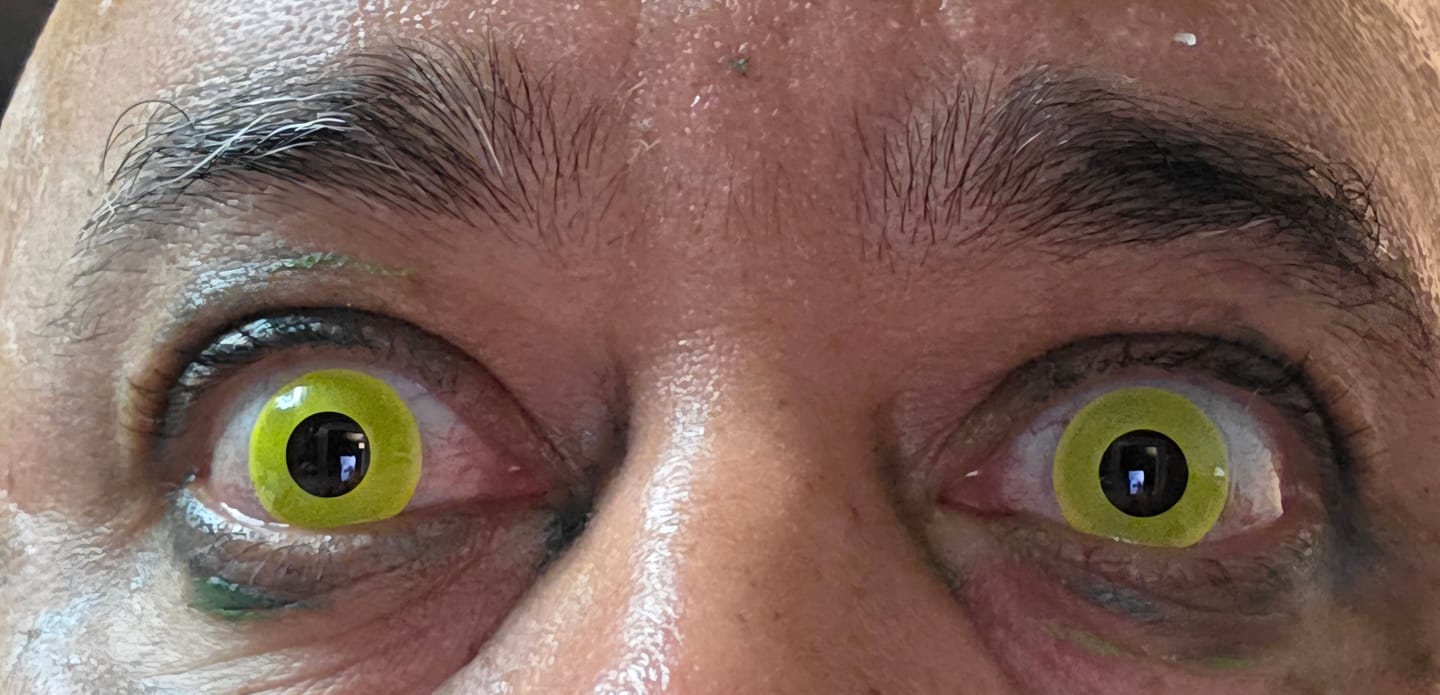 Customer photo review of Solid Yellow Contact Lenses