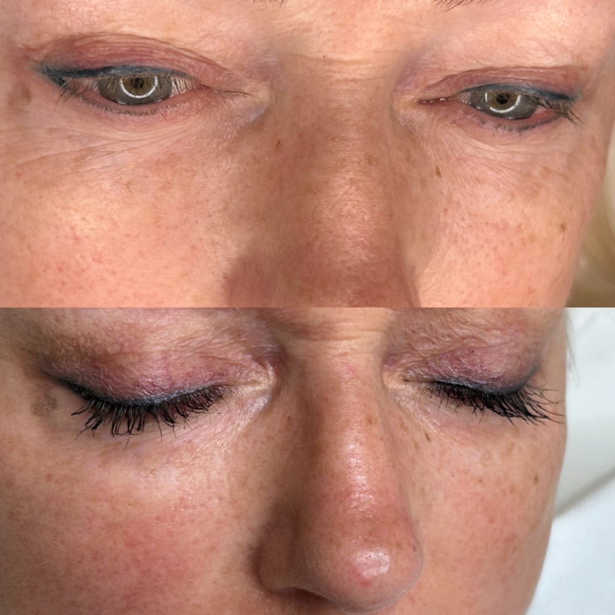 Customer photo review of Hairplus - Siero Ciglia e Sopracciglia +50% Lunghezza in 4 Settimane