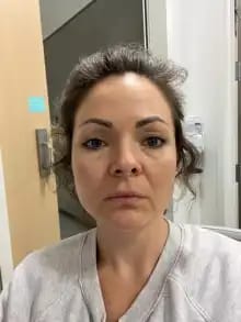 Customer photo review of Sistema de Microinfusão™ + Soro Bónus