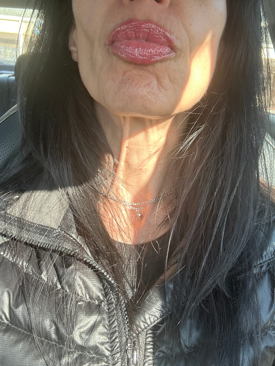Customer photo review of Extreme Lip Plumper