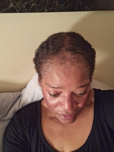 Customer photo review of Hair Growth Bundle
