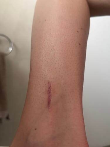Customer photo review of Hot & Hairless