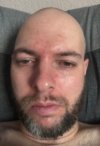 Customer photo review of Seb Natural Calming Serum