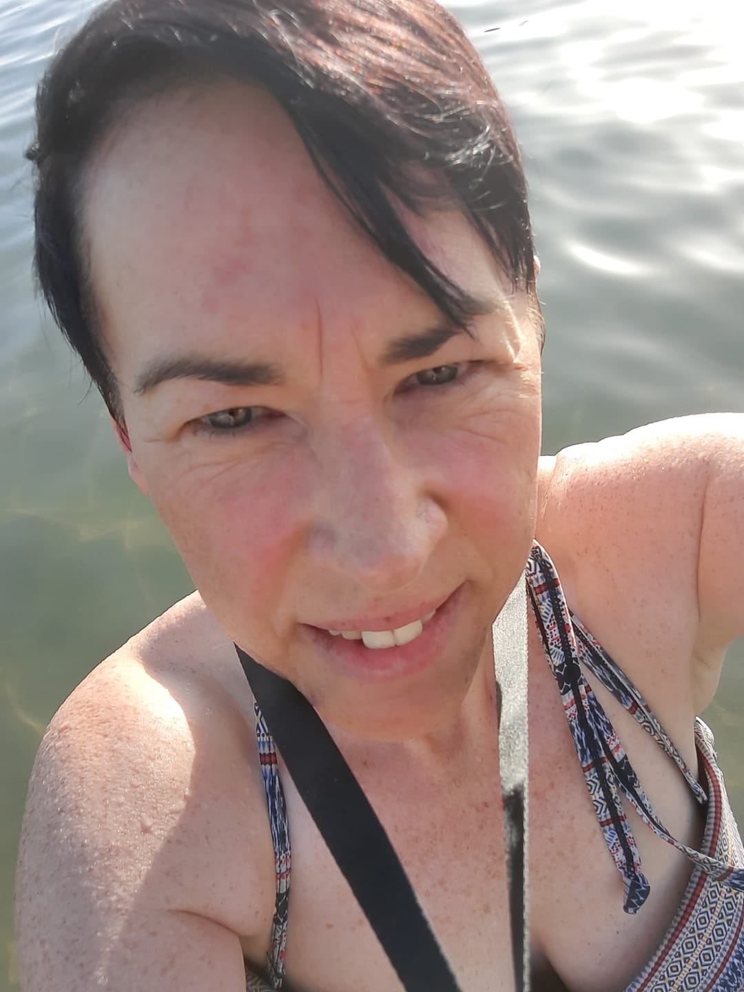 Customer photo review of Rosalique Redness Relief Day Cream