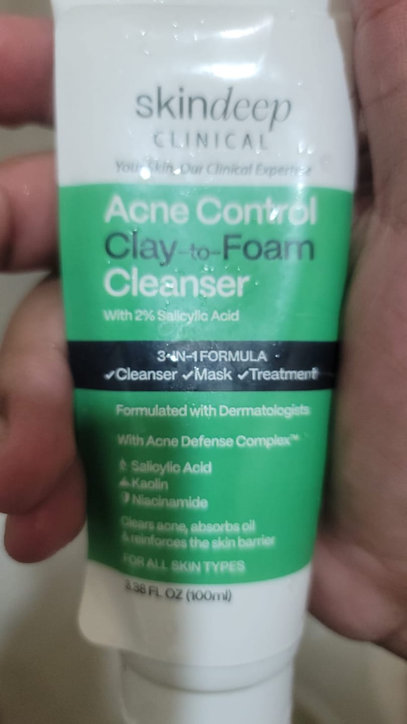 Customer photo review of Acne Control Clay-to-Foam Cleanser