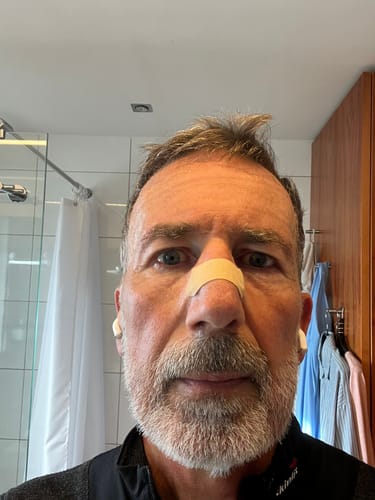 Customer photo review of Flowstrips® Nasenpflaster