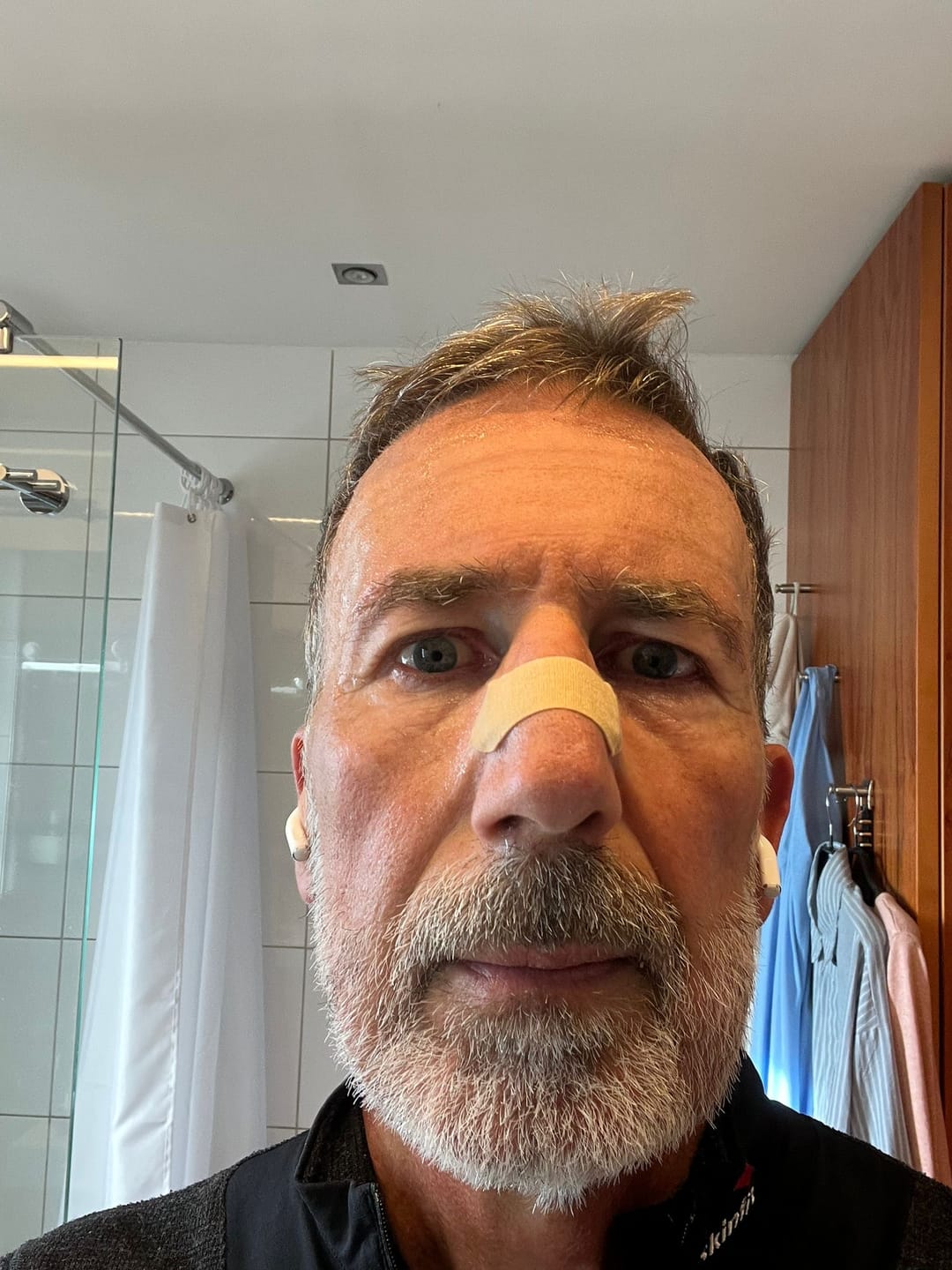 Customer photo review of Flowstrips® Nasenpflaster