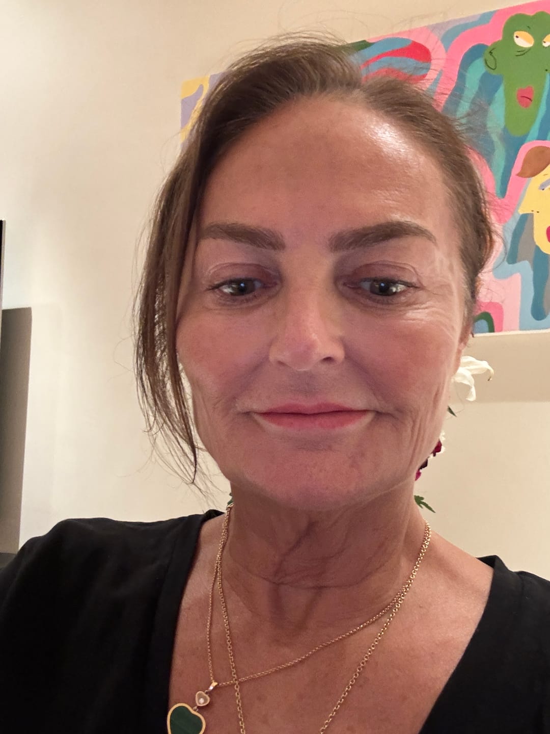 Customer photo review of Anti-Aging treatment