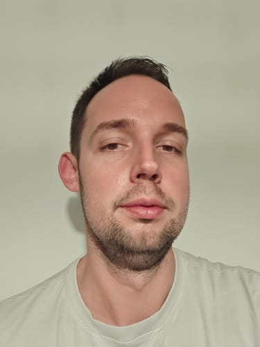 Customer photo review of Seb Natural Calming Serum