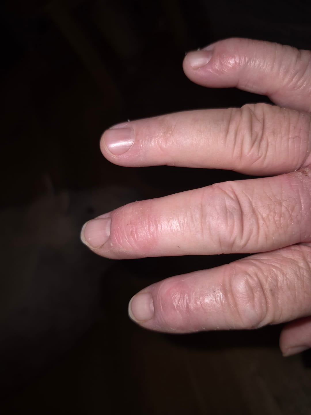Customer photo review of Bioskin Duo Pack