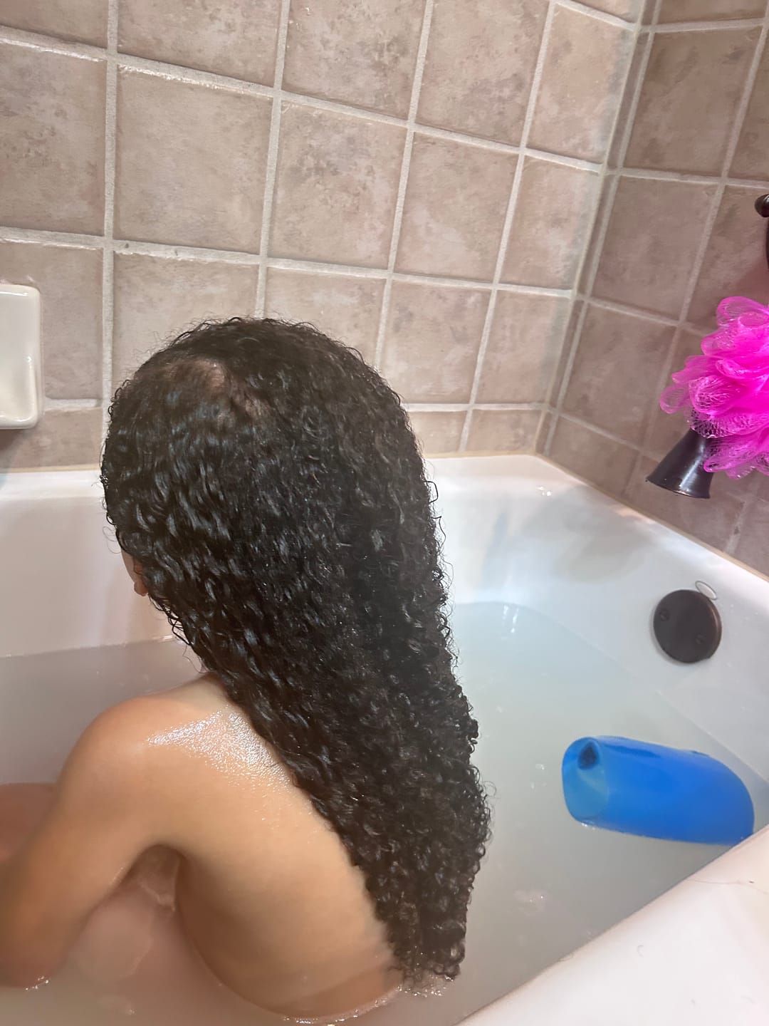 Customer photo review of Follicle Fuel Pro+ – Hair Growth Potion (Extra Strength)