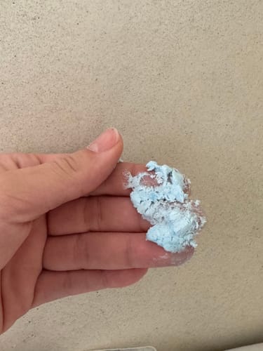 Customer photo review of Ingrown SOS