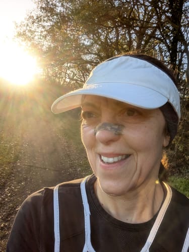 Customer photo review of Pink Nasal Strips