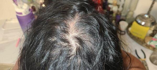 Customer photo review of Human Hair Topper 15*16cm Base All Shades