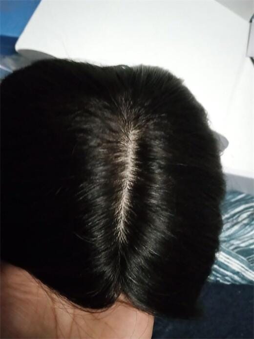 Customer photo review of Human Hair Topper 15*16cm Base All Shades