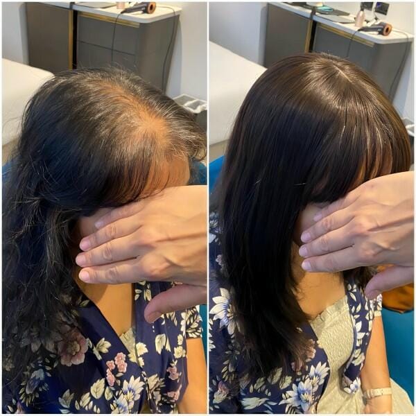 Customer photo review of Human Hair Topper 15*16cm Base All Shades