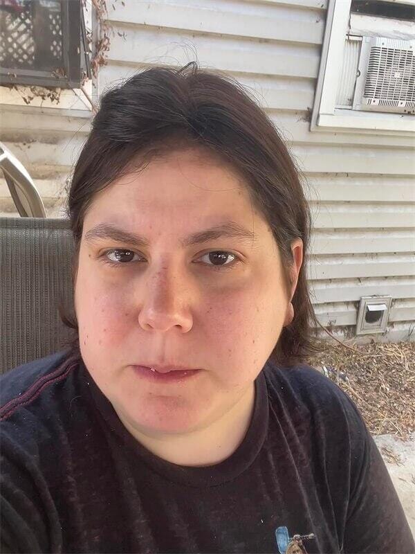 Customer photo review of Lily ︳Mono Base 3x5" Human Hair Topper For Thinning Hair