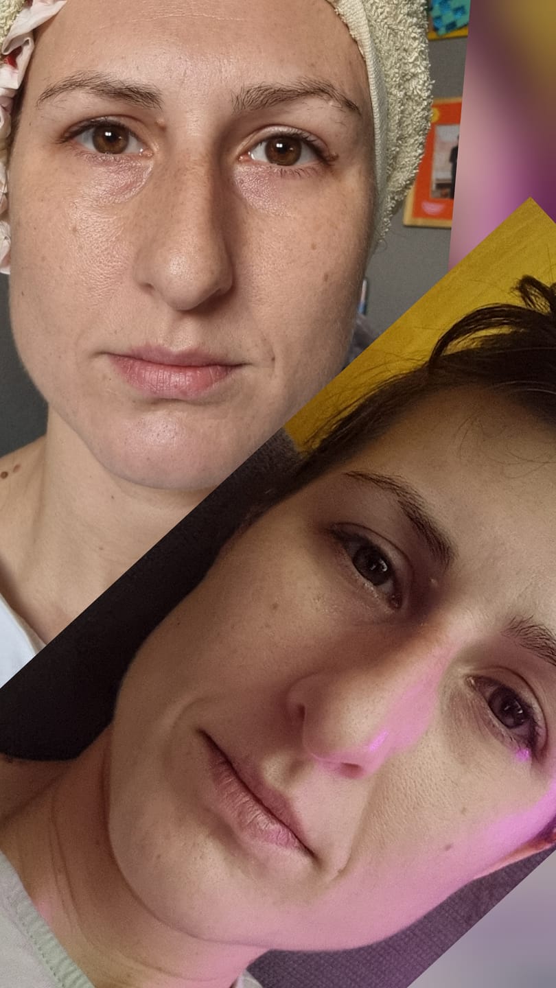 Customer photo review of The Ordinary Niacinamide 10% + Zinc 1%