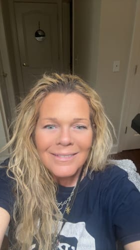 Customer photo review of 1 Month Supply of Seranova Microneedling Infusion System™