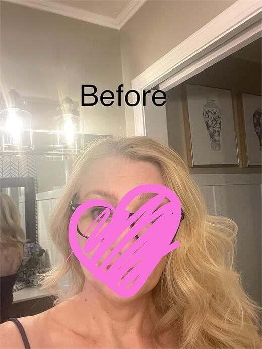 Customer photo review of Human Hair Topper 15*16cm Base All Shades