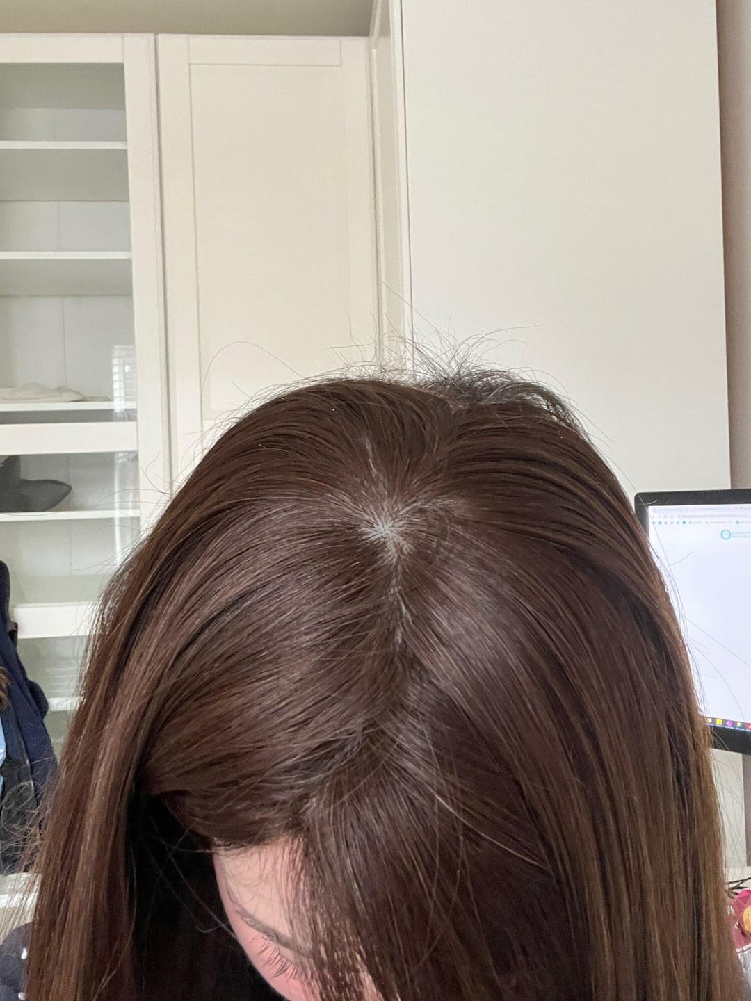 Customer photo review of Human Hair Topper 15*16cm Base All Shades