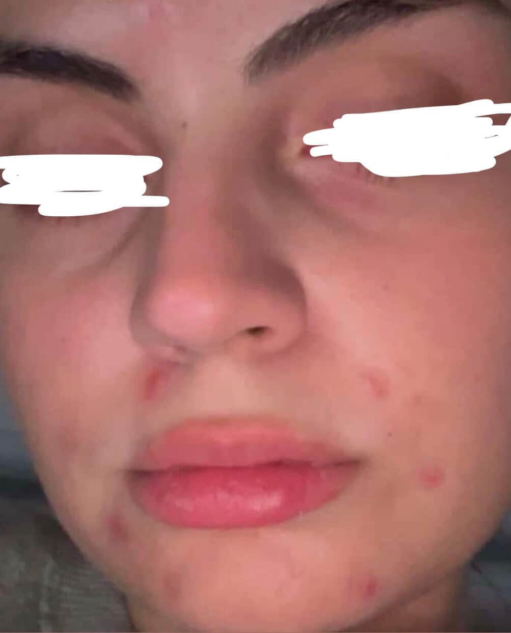 Customer photo review of ⚡ Turmeric Vitamin C Clay Mask