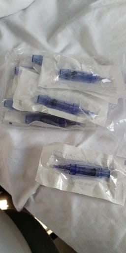Customer photo review of Microneedling Pen – Smoother Skin And Faded Scars