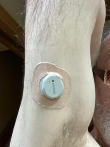 Customer photo review of Skin Grip Original - Dexcom G7 & Stelo Adhesive Patches (With Cutout)