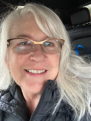 Customer photo review of F-Balm - Premium Anti-aging Tallow Balm - 2 oz.