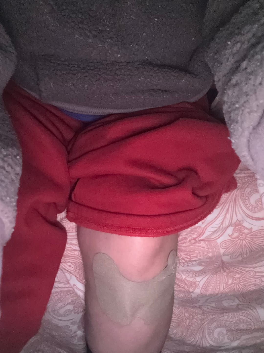 Customer photo review of Auxilium Knee and Joint Package (fka Heaven Patch)